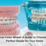 Braces Color Wheel: Everything You Need to Know